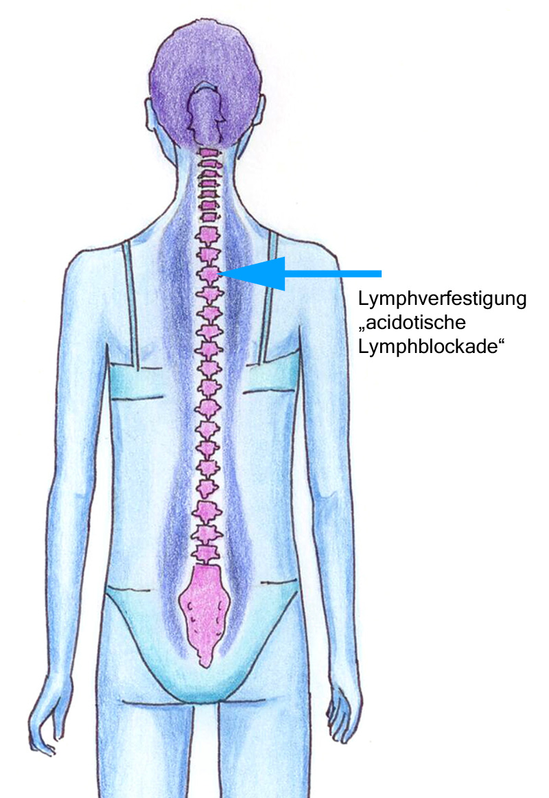 Lymphverfestigung