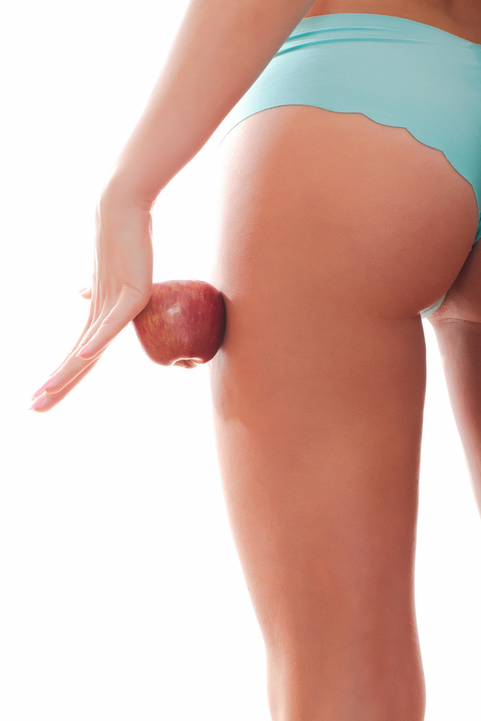 LIPÖDEM, LYMPHÖDEM